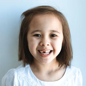 Is It Appropriate for Kids to Get Dental Implants?