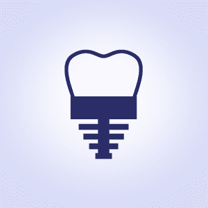 Why Choose Dental Implants Instead of a Root Canal?