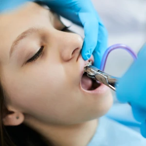 Dentist performing tooth extraction in Pittsburg with professional dental tools during patient treatment